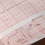 Grafico che illustra i battiti cardiaci irregolari e l'importanza di controlli medici.